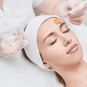 Chemical Peel Near Antioch, Antioch Chemical Peel, Best chemical peel near Antioch